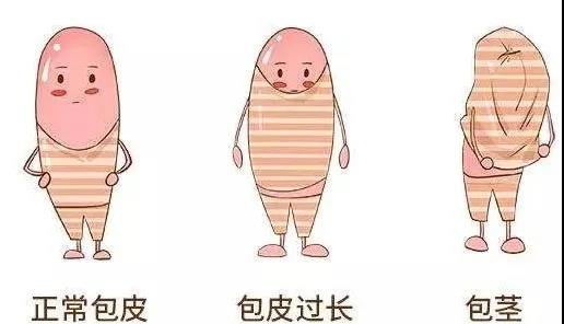【保山安利醫(yī)院】家長(zhǎng)速看！暑期包皮手術(shù)預(yù)約正當(dāng)時(shí)！